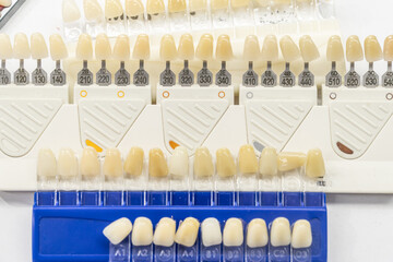 Organized dental shade guides with alphanumeric labels displaying various tooth colors for precise restorations and treatment planning