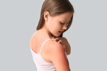 Little girl with red sunburned skin on grey background