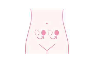 卵胞ホルモンテープを貼る位置は毎回変える