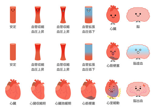 ヒートショック　気温による血管、血圧の変化セット