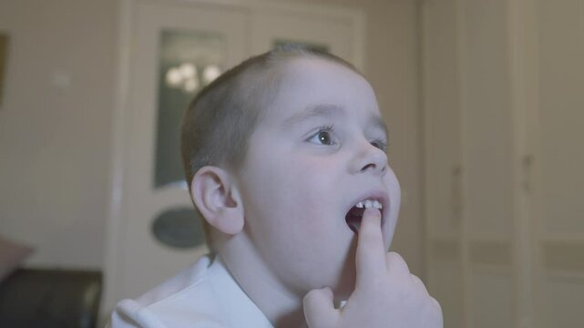 Child Wiggling His Front Milk Teeth. Child Showing His Milk Tooth Before Losing It. Replacement Of Permanent Changing Teeth.