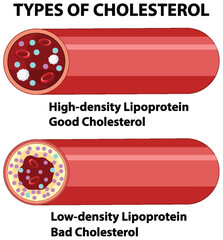 Understanding Types of Cholesterol