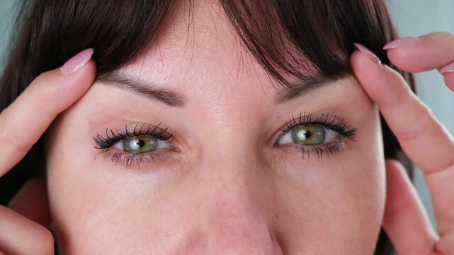 The woman has a drooping eyelid