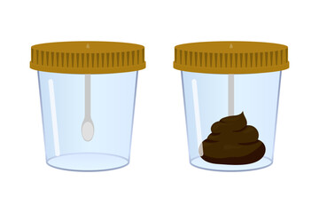 Stool sample in medical container and empty container with spoon