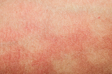 human skin texture