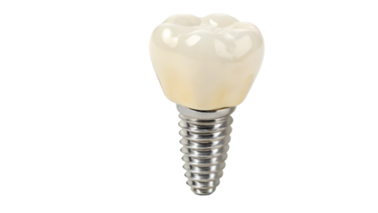 Dental implant with realistic crown design for restorative dentistry