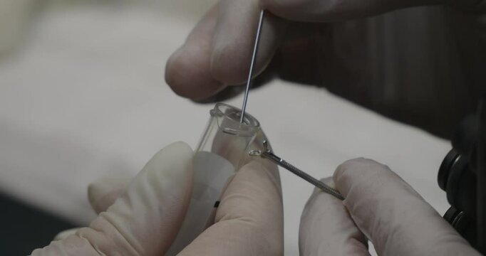 The veterinarian carefully places a small tissue sample collected during a cat gastroscopy into a labeled tube using special instruments. Taking a biopsy during a cat gastroscopy.