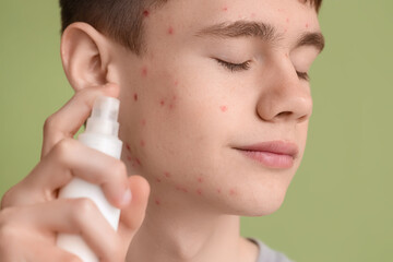 Teenage boy with acne and skincare product on green background, closeup