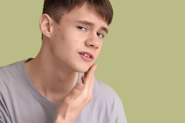 Teenage boy with acne on green background, closeup