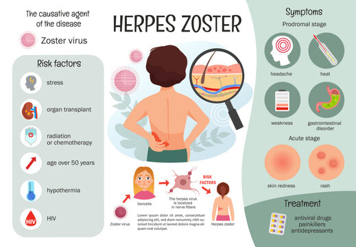 Vector infographics herpes zoster. Medical poster zoster virus risk factors and symptoms. Cartoon illustration man with shingles.
