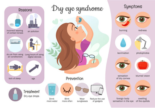 Vector medical infographics dry eye syndrome. Illustration cute girl dripping drops into eyes. Symptoms, causes of red eye disease.