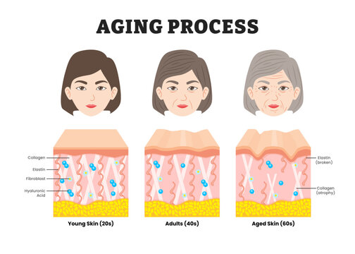 Aging process, educational medical poster design healthcare scheme, labeled comparison of Young, Adults and aged skin, Collagen, Elastin, Hyaluronic acid and fibroblasts. Face skin structure changes.
