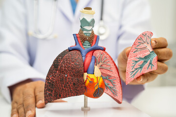 Pneumonia, lung cancer, Asian doctor holding human anatomy model for study diagnosis and treatment...