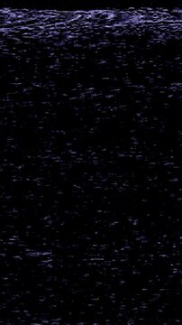 TV Noise and Static, Analog Glitch, Bad Signal, and Distorted Retro Visuals on Black Screen