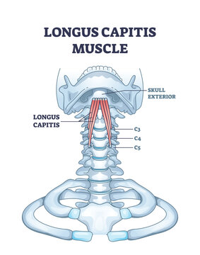 Longus capitis muscle anatomy is shown with labeled cervical vertebrae and skull base, highlighting muscle location. Outline diagram