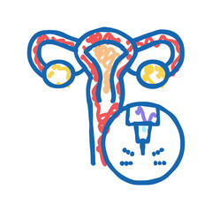 uterus medical laser treatment icon doodle illustration
