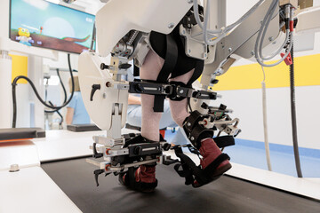 Child using robotic gait trainer for walking therapy on a treadmill at pediatric rehabilitation clinic