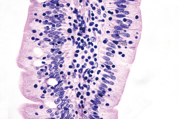 This is a histological picture of human small intestine, focusing on simple columnar epithelium, including goblet cells and absorptive cells. Magnification 1000x

