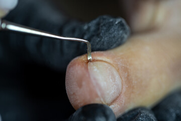 Close-up of metal tool cleaning under toenail during professional pedicure treatment in salon