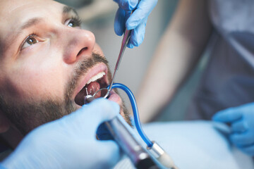 Young man at dentist. Shallow DOF. Developed from RAW; retouched with special care and attention;...