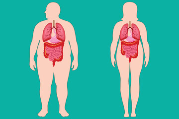 Human anatomy illustration showing internal organs in obese male and female body silhouettes. eps 10