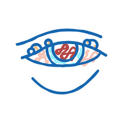blepharitis disease, redness of eyeball icon doodle illustration
