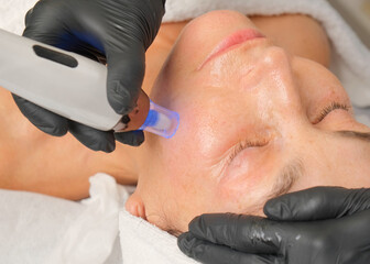 Close-up portrait of a beautiful aged woman during microneedling with dermapen from a beautician.