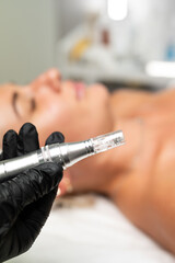 Microneedle RF lifting procedure. A cosmetologist performs a facial rejuvenation procedure on a...
