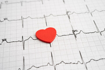 Electrocardiogram ECG heart wave, heart attack, cardiogram report.