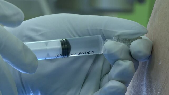 Doctor Injecting Medication Via Spinal Tap. An Anesthesiologist Injects A Local Injection Of Anesthesia Under The Spinal Element 
