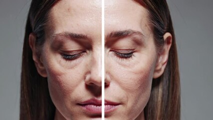 Woman showing before and after cosmetic procedures on face
