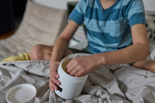Little boy with eczema applying cream