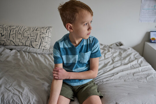 Child's arms and legs with eczema