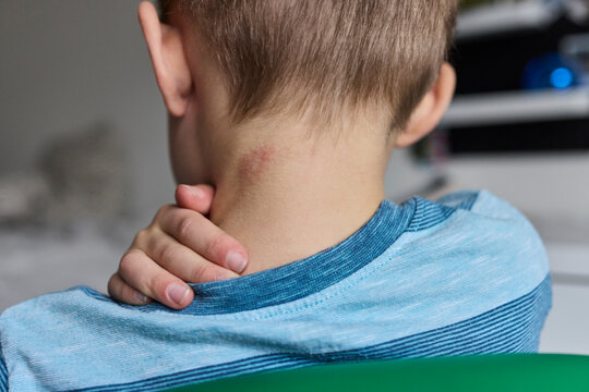 Little boy uses humidifier in his room to ease eczema