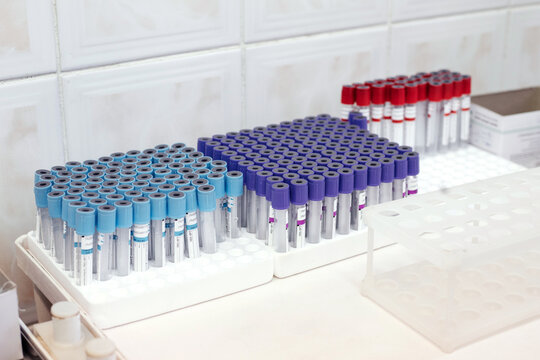 Blood testing tubes arranged on white desk in medical laboratory.
