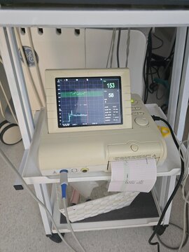A fetal monitor display shows real-time heart rate and uterine contractions, with numerical readings on the right side.
