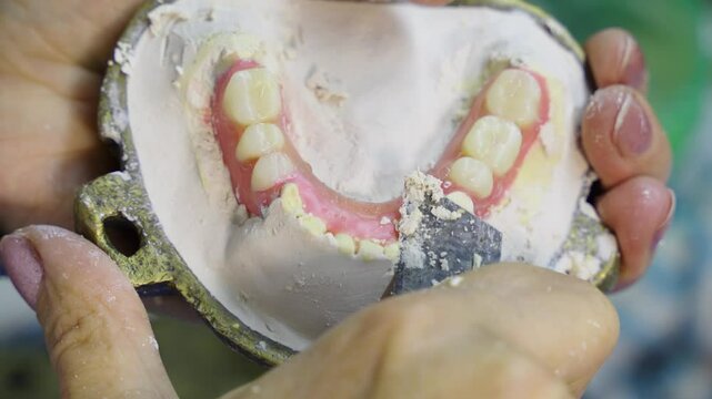 Close-up of a technician removing excess plaster from a mold containing a pink lower partial denture with artificial teeth.