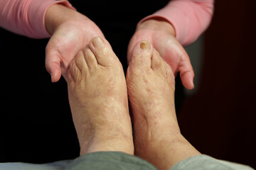 Fototapeta premium Beautician gently examining elderly woman's damaged toenails, providing specialized foot care and treatment