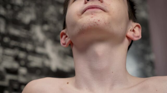Teenager swallows, close up neck and Adam apple. Adolescent boy swallowing, throat. Young male swallows during pubertal period