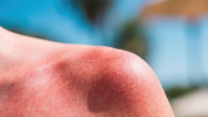 A close up of a red skin