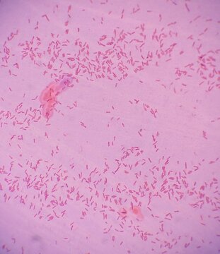 Gram stain of the bacteria E.coli or Escherichia coli. E.coli is gram negative causing the cells to be stained pink or red due to retaining the colour of the counterstain, safranin.