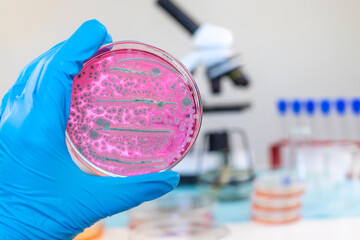 Examine bacteria in petri dishes in the laboratory. Selective focus.