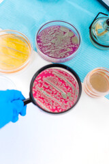 Examine bacteria in petri dishes in the laboratory. Selective focus.