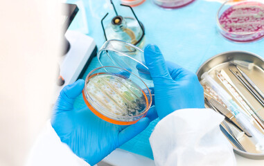 Examine bacteria in petri dishes in the laboratory. Selective focus.