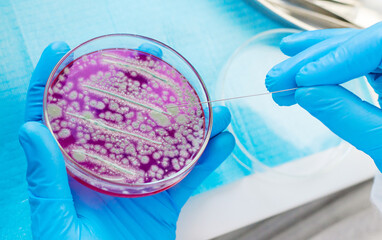 Examine bacteria in petri dishes in the laboratory. Selective focus.