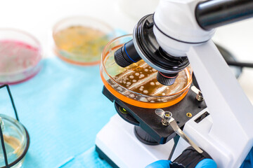 Examine bacteria in petri dishes in the laboratory. Selective focus.