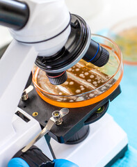 Examine bacteria in petri dishes in the laboratory. Selective focus.