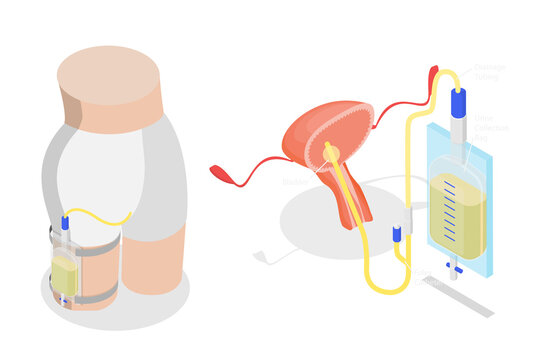 3D Isometric Flat  Illustration of Drainage Bladder, Flexible Rubber Urine Bag For Bladder Infections Treatment
