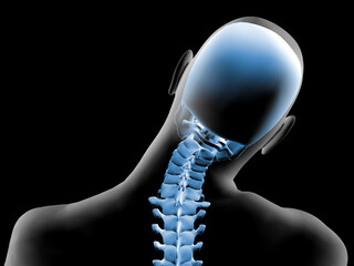 3d X-ray of painful neck