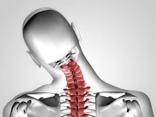 3d X-ray of painful neck